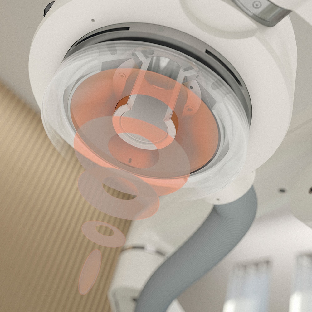 Mechanotransduktion - Herz-Stosswellen-Therapie - mechanische Signale