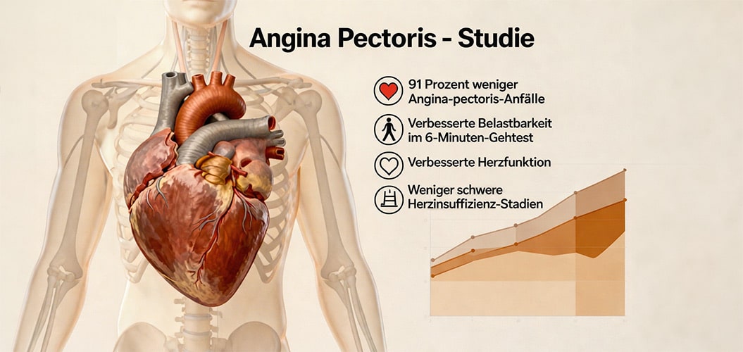Angina Pectoris - CSWT-Studie - Dr. Meyer